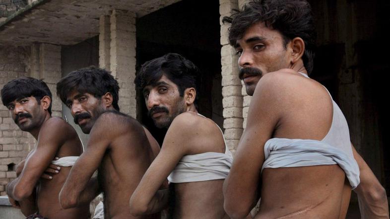 Četverica iz neke pakistanske vasi, ki so prodali ledvico, da bi poplačali dolgo