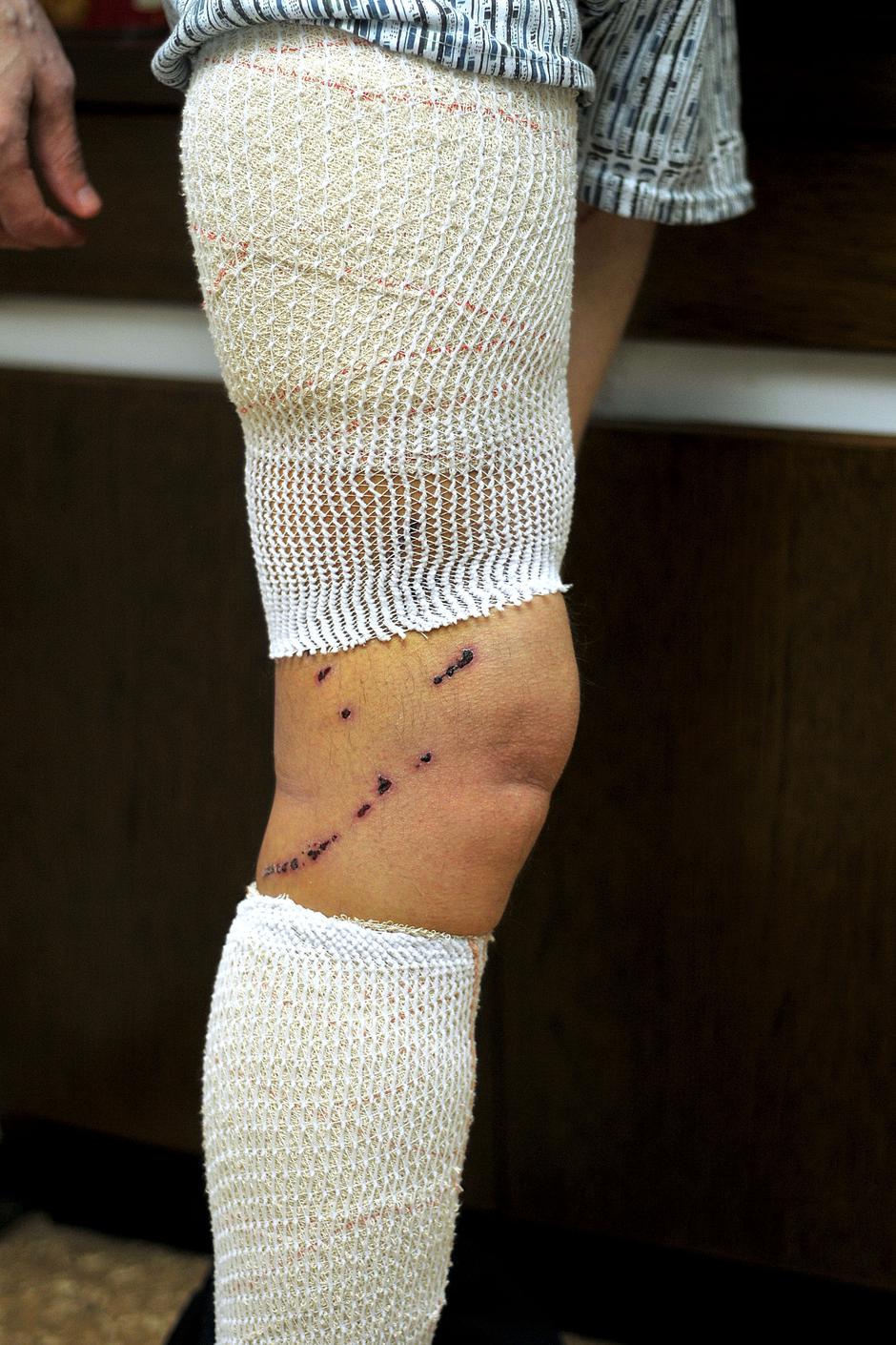 napad medveda, hrustovo, medved, ho%C4%8Devar, %C5%BErtev napada | Avtor: Žurnal24 main