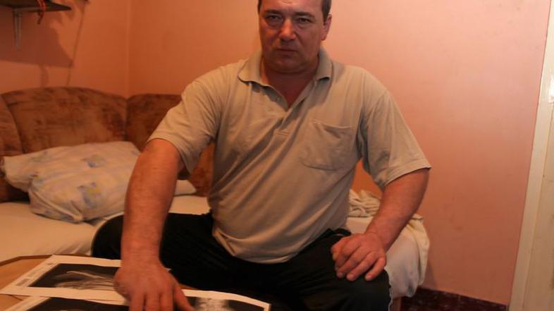 Pervanja je izgubil mezinec in del dlani. (Foto: 24sata)