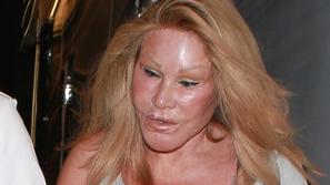 Jocelyn Wildenstein