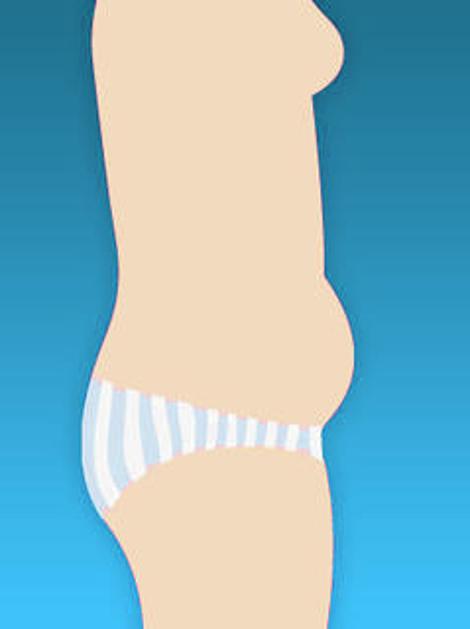 Napihnjen spodnji del trebuha